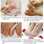 Suai 20ml Nail Fungal Treatment Care Essence Foot Toe Fungus Removal Gel