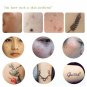 2018 Electric Laser Age Spot Pen Mole Warts Freckle Scars Removal Machine