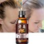 1Pc 30ML 7 Days Ginger Germinal Serum Essence Oil Loss Treatment Growth Hair