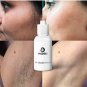 10ml Hair Growth Inhibitor Hair Removal Essence Skin Care Lotion Repair Herbal Y