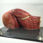 Boxing Glove Display Case HORIZONTAL with two-tier black acrylic base
