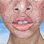 Lips 24"x30" Archival Print of original acrylic painting by Niccolle Breeden.