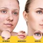 Gorgesqin Anti Pigmentation Cream 10gm Reduces & Removes Pigmentation From 7 Day