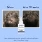 WishCare Hair Growth Serum Concentrate for Men & Women 30ml Fragrance Free Vegan