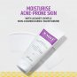 Brinton AcMist Moisturizing Cream Gel 50gm for Acne Prone and Oily Skin Dry Skin