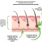 DERMA_ROLLER