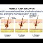 FOLLICLE-REBOOT