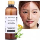 Whitening Kojic Acid Face Cream Skin Intensive Serum Freckle Acne Spots Remove