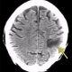 Imaging - CT   MRI