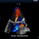 Imaging - Ultrasound