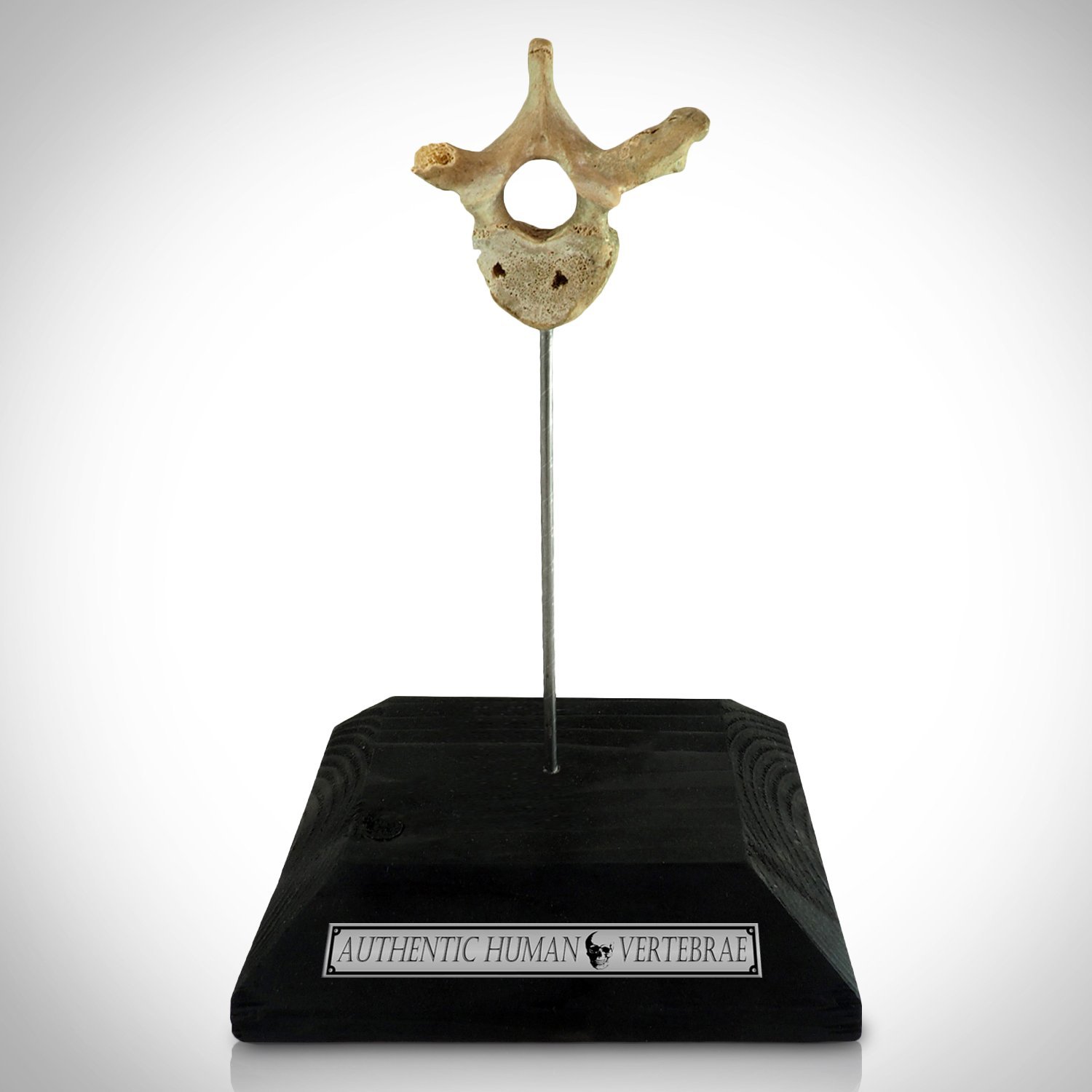 Human Vertebrae - Authentic Human Vertebrae Display Stand