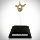 Human Vertebrae - Authentic Human Vertebrae Display Stand