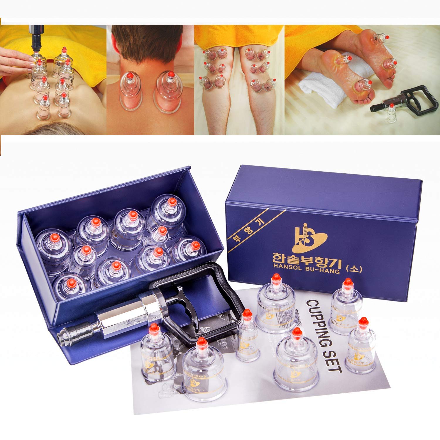 Hansol Professional Cupping Therapy Equipment Set with pumping handle 10 Cups