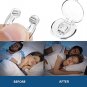 Skyloa Anti Snoring Devices
