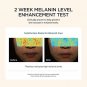 Goodal Green Tangerine Vitamin C Dark Spot Facial Serum+ for Sensitive Skin | Dark Spot Treatment, A