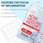 Acne Pimple Patches, Healing Invisible Acne Patches for Acne Treatment, Pimple Patch for all skin ty