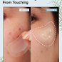 I Dew Care Hydrocolloid Acne Pimple Patch - Timeout Blemish Chin & Cheeks | 9 Count (31 x 46 mm), Fa