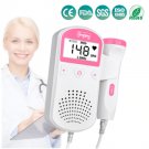 Fetal Doppler  baby monitor