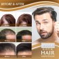 iBeaLee Hair Growth Products Biotin Anti Hair Loss Spray Scalp Treatment Fast Growing Hair Care