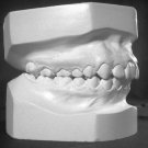 Dental gypsum powder tipe IV 1.5 LBS ( crow , bridge , acrylic resin ) moldeling
