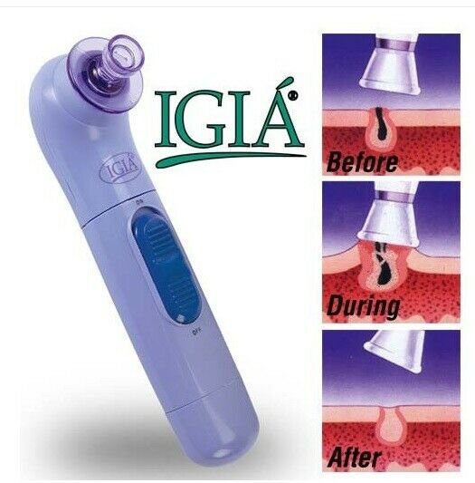 Igia Pore Cleanzer Vacuum Blackhead Acne Cleaner Remover Electric Skin Facial