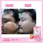 Froza Gluta Pure Whitening Aura Collagen Lightening Max Glutathione Skincare