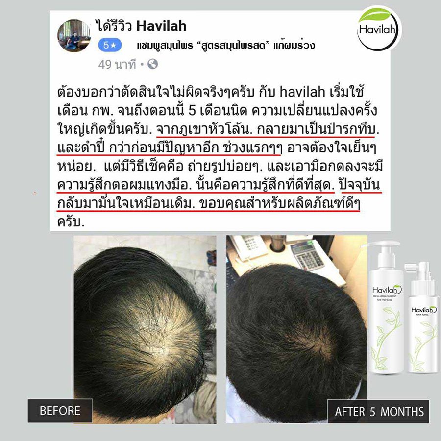 Anti Premium Fall Hair Havilah 300ml Regrowth Thai Natural Loss Regrow ...