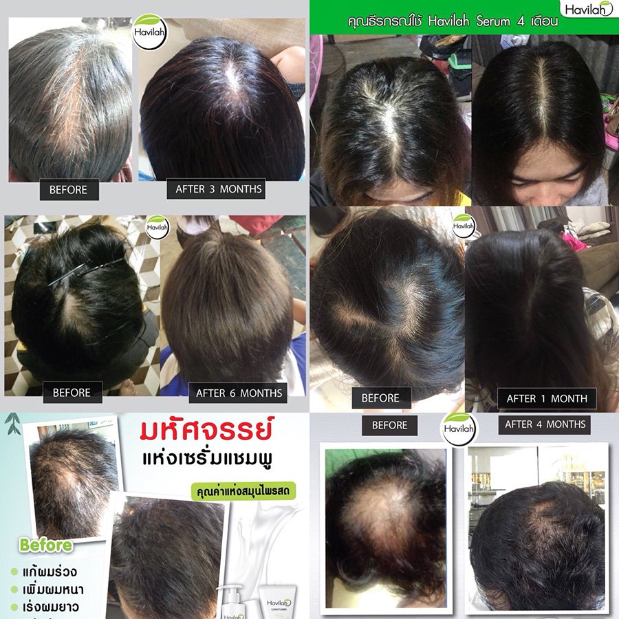 300ml 200ml Hair Fall Regrow Shampoo Anti Natural Prevent Loss Herbal ...