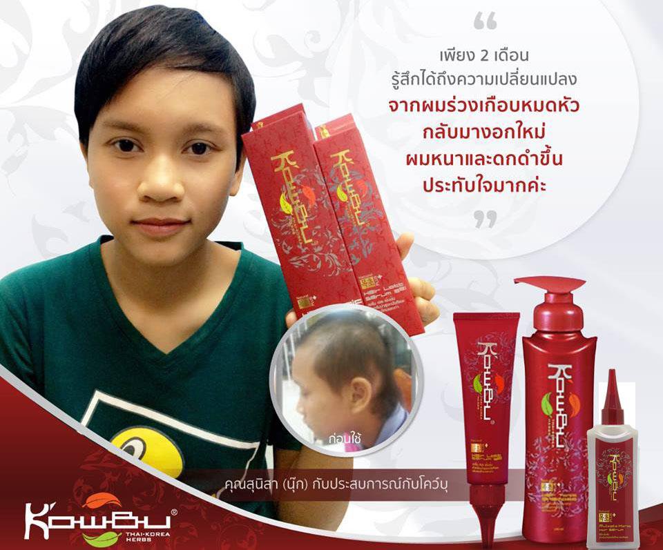 Regrow Serum Loss Hair 60ml Kowbu Hair Regrowth Anti Hair Gel Fall Lott