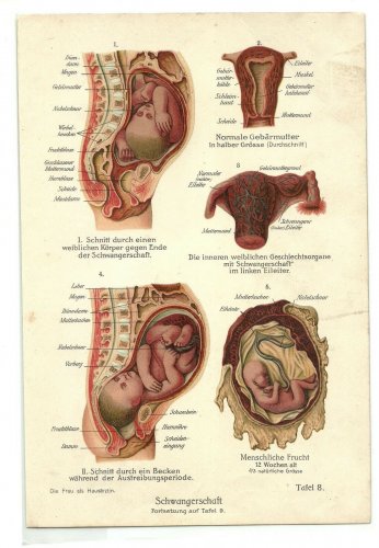 1890 - pregnancy pregnant pregnancy chromo lithograph lithograph