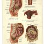 1890 - pregnancy pregnant pregnancy chromo lithograph lithograph