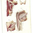 1864 - Handcolored steel engraving, Dr. Joseph Nicolas Masse's