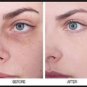 ACHROACTIVE&Acirc;&reg; MAX 45ml CREAM WHITENING EFFECT CLINICALLY TESTED, UV filter, Vitamin C, Achromaxyl&acirc;�&cent;