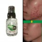 MULTIACTIVE PEARLS 30ml SERUM SNAIL EXTRACT + HYALURONIC ACID Anti age Anti acne
