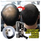 Scalp Intense Roll-on Hair Growth Serum