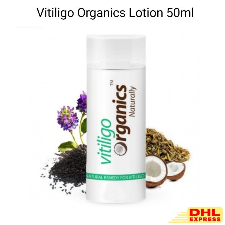 Vitiligo Organics Lotion 50ml &acirc;�� Herbal Support for Uneven Skin Tone / White Spot