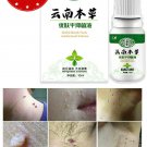 Natural Genital Wart Treatment Papilloma Removal Warts Liquid Skin Tags 10ml USA