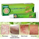 Sumifun Eczema Cream Antiseptic Healing Bed Sores Acne