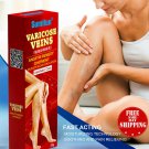Sumifun Varicose Veins Ointment for Vasculitis Phlebitis Leg Spider Angiitis