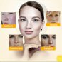 Natural Freckle Dark Spot Melasma Sun Spot Age Spot Pregnancy Spot Removal Cream