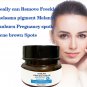 Natural Freckle Dark Spot Melasma Sun Spot Age Spot Pregnancy Spot Removal Cream