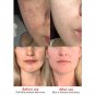 Papaya Freckle Dark Spot Sun Spots Melasma removing cream 2pcs