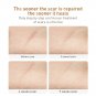 LANBENA Pimple Scar Acne Spots Gel Cream