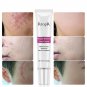 Scar Removal Acne Scar Treatment Cream Scar Repair Acne