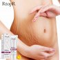 RtopR Mango Stretch Marks Remover Cream Eliminate Maternity Repair Skin