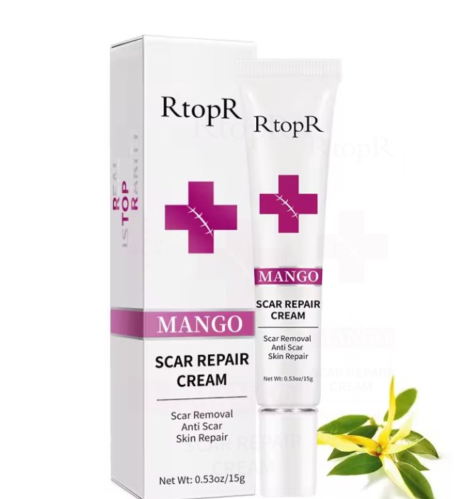 Acne Pimple Scar Acne Mark Spots Removal Treatment Gel Ointment Cream