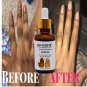 Knuckle Serum