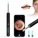 Ear Wax Removal Tool with Camera, BEBIRD Ear Cleaner Otoscope Wireless, Ultra Cl