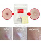 COSRX Acne Pimple Master Patch 6 sheets X 24 patches NEW COSRX Acne Pimple Master Patch 6 sheets X 24 patches NEW