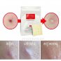NEW COSRX Acne Pimple Master Patch  6 sheets X 24 Patches Reduce Acne Spots